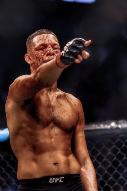 Nate Diaz