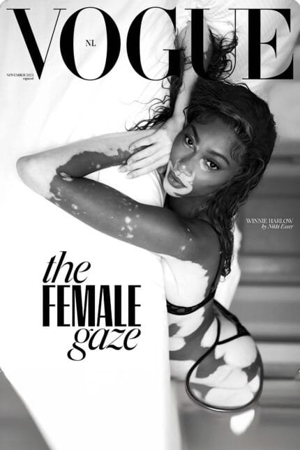 Winnie Harlow – VOGUE